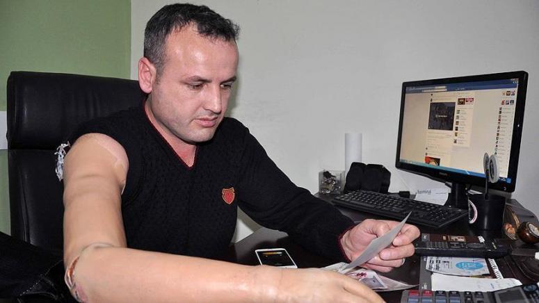Gazi Akyol 'Vatan için sol kolumuda veririm'