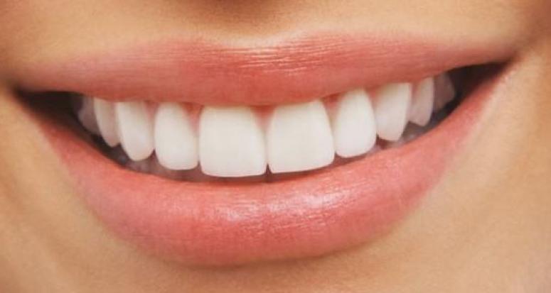 Beyazlatma işlemi diş sağlığı için zararlı mı?